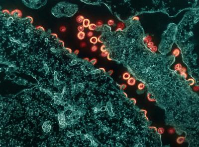 Pink and tan colored HIV-1 virus particles budding and replicating from a segment of a teal colored chronically infected H9 cell.