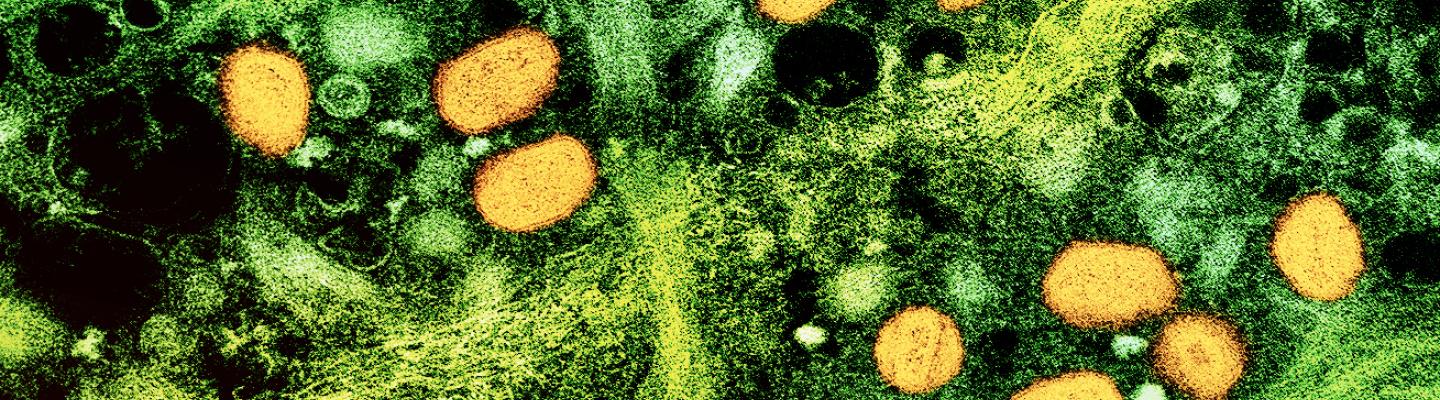 mpox particles in an infected cell.