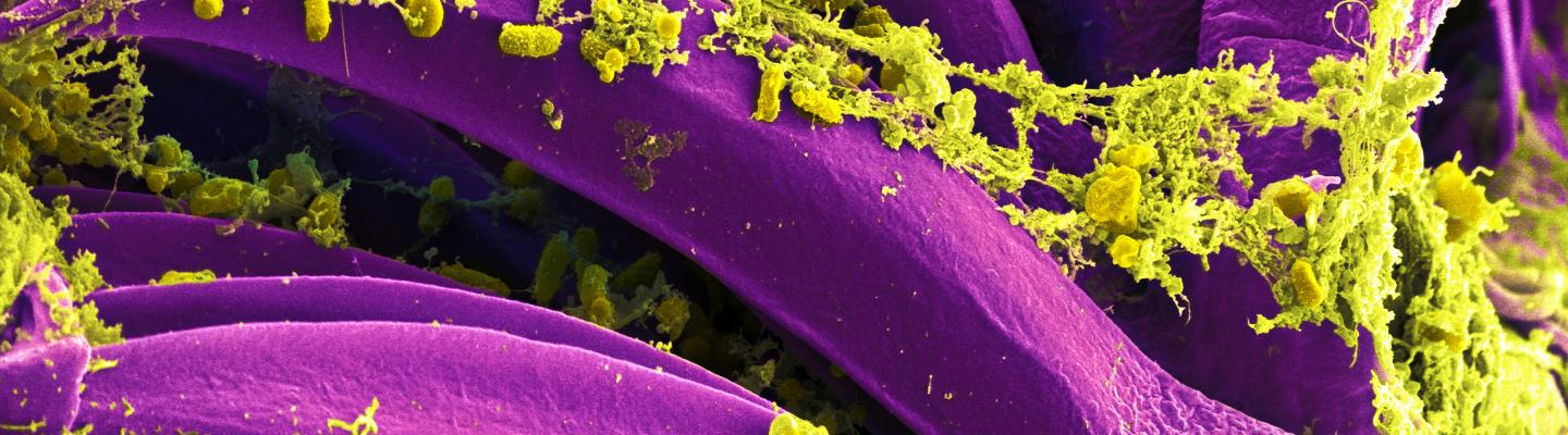 Scanning electron micrograph showing Yersinia pestis, which causes bubonic plague