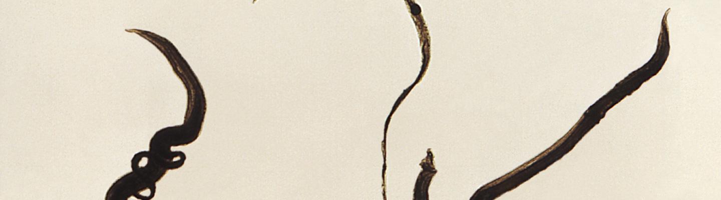 Magnified image of Schistosoma mansoni trematodes